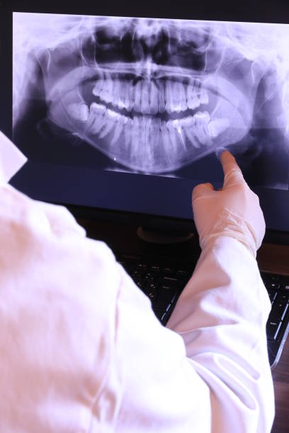 Best Emergency Wisdom Teeth Removal in Morgan, UT