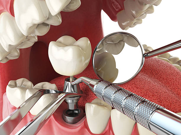 Best Emergency Dental Surgery in Morgan, UT